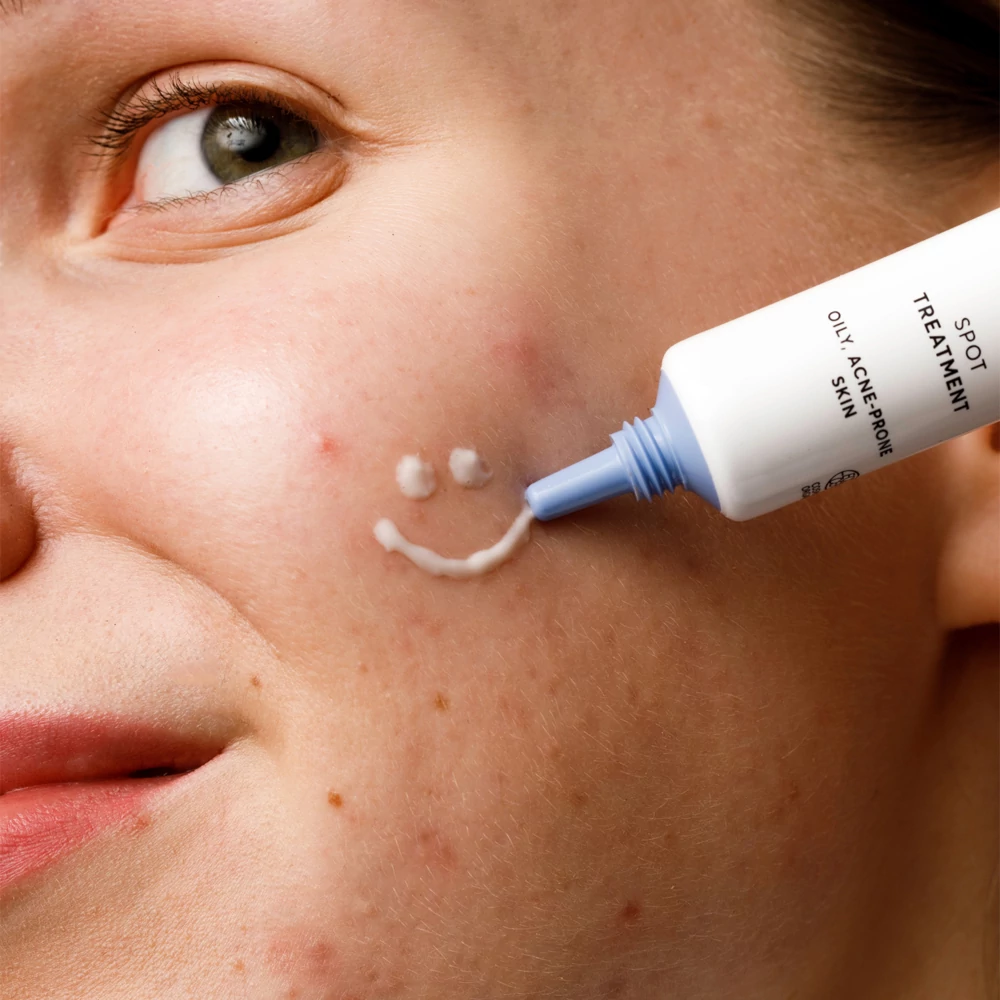 mossa acne act spot treatment